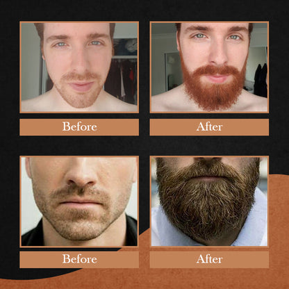 Reborn Organic Beard Growth Oil