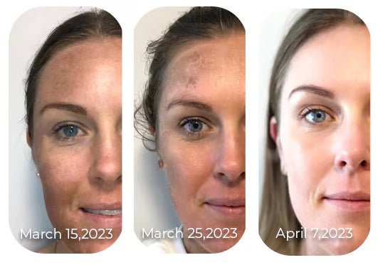 🎉Seurico™ Vitamin C Revitalizing Face Cream – Moisturizing, Brightening, Wrinkle-Reducing, Firming, and Anti-Aging