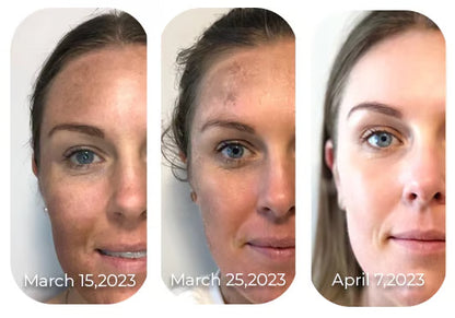 🎉Seurico™ Vitamin C Revitalizing Face Cream – Moisturizing, Brightening, Wrinkle-Reducing, Firming, and Anti-Aging